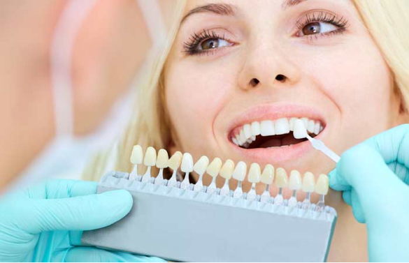 Woman getting veneers